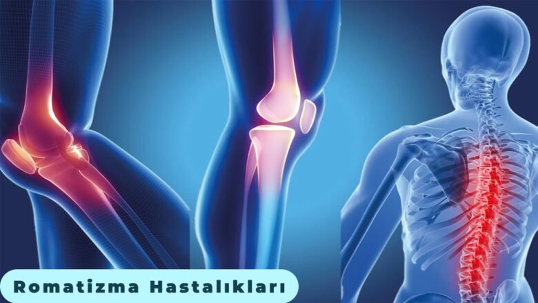 Dex Forte Diş Ağrısına İyi Gelirmi? Kuvvetli Ağrı Kesici - Güncel ...