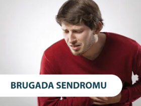 Brugada Sendromu Nedir? Tedavisi Nelerdir?