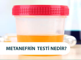 Metanefrin Testi Nedir? Normetanefrin Neden Yapılır?