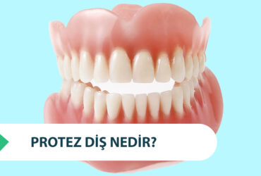 Protez Diş Nedir? Çeşitleri Nelerdir?  