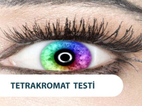 Tetrakromat Testi Fazladan 9 Milyon Renk Görüyor Musun?