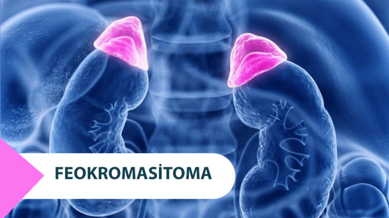 Feokromasitoma (Böbrek Üstü Bezi Tümörü) Nedir ?