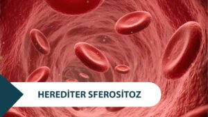 Herediter Sferositoz Belirtileri Nelerdir? Tedavi Var Mı?