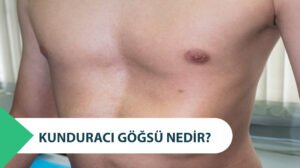 Kunduracı Göğsü Nedir? Tedavisi Var Mı?