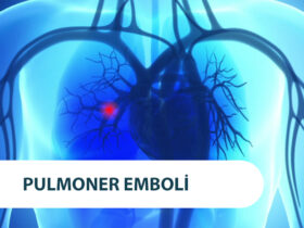 pda nedir