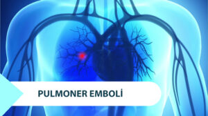 Pulmoner Emboli (Akciğere Pıhtı Atması) Nedir?
