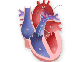 pda nedir
